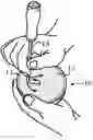 Fig. 01 - KEYSTONE GAME CALL