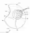 Fig. 01 - Nipple shield