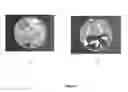 Fig. 07 - SHAPE MEMORY COMPOSITION COMPRISING STARCH