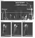Fig. 03 - Compositions and Methods for Modulating Neuron Degeneration and Neuron Guidance