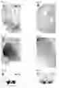 Fig. 08 - Compositions and Methods for Modulating Neuron Degeneration and Neuron Guidance