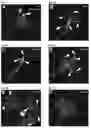 Fig. 14 - Compositions and Methods for Modulating Neuron Degeneration and Neuron Guidance