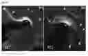 Fig. 15 - Compositions and Methods for Modulating Neuron Degeneration and Neuron Guidance