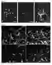 Fig. 20 - Compositions and Methods for Modulating Neuron Degeneration and Neuron Guidance