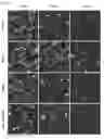 Fig. 21 - Compositions and Methods for Modulating Neuron Degeneration and Neuron Guidance