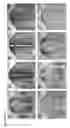 Fig. 33 - Compositions and Methods for Modulating Neuron Degeneration and Neuron Guidance