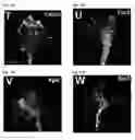 Fig. 35 - Compositions and Methods for Modulating Neuron Degeneration and Neuron Guidance