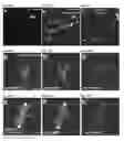 Fig. 40 - Compositions and Methods for Modulating Neuron Degeneration and Neuron Guidance