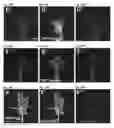Fig. 55 - Compositions and Methods for Modulating Neuron Degeneration and Neuron Guidance