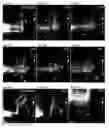 Fig. 61 - Compositions and Methods for Modulating Neuron Degeneration and Neuron Guidance