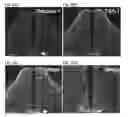 Fig. 65 - Compositions and Methods for Modulating Neuron Degeneration and Neuron Guidance