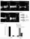 Fig. 70 - Compositions and Methods for Modulating Neuron Degeneration and Neuron Guidance