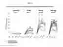 Fig. 03 - Method for treating hyperuricemia employing an SGLT2 inhibitor and composition containing same