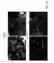 Fig. 12 - Kinase protein binding inhibitors