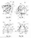 Fig. 06 - Adjustable tension ring for amelioration of urinary incontinence in females