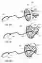 Fig. 08 - Adjustable tension ring for amelioration of urinary incontinence in females