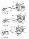 Fig. 09 - Adjustable tension ring for amelioration of urinary incontinence in females