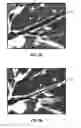 Fig. 04 - System and method for determining airway diameter using endoscope