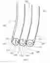 Fig. 04 - COMBINATION ENDOSCOPIC OPERATIVE DELIVERY SYSTEM