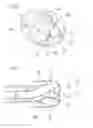 Fig. 04 - ENDOSCOPIC INSTRUMENT