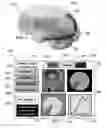 Fig. 07 - METHOD AND SYSTEM FOR QUANTITATIVE ASSESSMENT OF FACIAL EMOTION NULLING