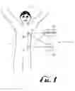 Fig. 02 - Needle insertion systems and methods