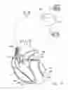 Fig. 10 - SYSTEM AND METHOD FOR USE WITH AN IMPLANTABLE MEDICAL DEVICE FOR DETECTING STROKE BASED ON PHYSIOLOGICAL AND ELECTROCARDIAC INDICES