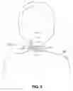 Fig. 05 - System and method for anticipating the onset of an obstructive sleep apnea event