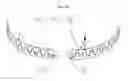 Fig. 11 - Respiratory Inductive Plethysmography Band