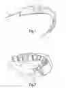 Fig. 02 - DEVICE FOR THE DETECTION OF SYMPTOMATIC JAW BEHAVIOUR
