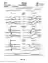 Fig. 16 - Methods for Diagnosis and Treatment of Processing Difficulties, Integration Problems, Imbalances and Abnormal Postures