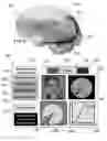 Fig. 07 - METHOD AND SYSTEM FOR QUANTITATIVE ASSESSMENT OF FUNCTIONAL IMPAIRMENT