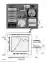 Fig. 16 - METHOD AND SYSTEM FOR QUANTITATIVE ASSESSMENT OF FUNCTIONAL IMPAIRMENT