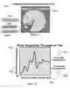 Fig. 40 - METHOD AND SYSTEM FOR QUANTITATIVE ASSESSMENT OF FUNCTIONAL IMPAIRMENT