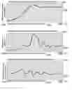 Fig. 41 - METHOD AND SYSTEM FOR QUANTITATIVE ASSESSMENT OF FUNCTIONAL IMPAIRMENT