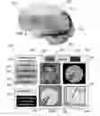 Fig. 07 - METHOD AND SYSTEM FOR QUANTITATIVE ASSESSMENT OF VISUAL FORM DISCRIMINATION