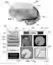 Fig. 07 - Method and system for quantitative assessment of visual motion discrimination