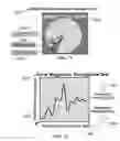 Fig. 40 - Method and system for quantitative assessment of visual motion discrimination