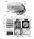 Fig. 07 - Method and system for quantitative assessment of spatial distractor tasks