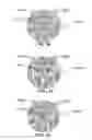 Fig. 27 - Method and system for quantitative assessment of spatial distractor tasks