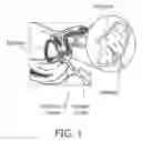 Fig. 02 - BIOPSY DEVICE WITH ACOUSTIC ELEMENT