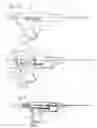 Fig. 07 - Device for Biopsy of Tumors