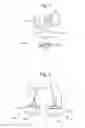 Fig. 02 - Prosthetic device and system and method for implanting prosthetic device