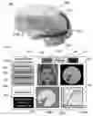 Fig. 07 - METHOD AND SYSTEM FOR QUANTITATIVE ASSESSMENT OF VISUAL MOTOR RESPONSE