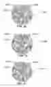 Fig. 27 - METHOD AND SYSTEM FOR QUANTITATIVE ASSESSMENT OF VISUAL MOTOR RESPONSE