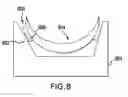 Fig. 09 - Device and method for opening an airway
