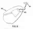Fig. 10 - Device and method for opening an airway