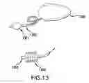 Fig. 14 - Device and method for opening an airway