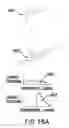 Fig. 17 - Device and method for opening an airway