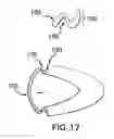 Fig. 20 - Device and method for opening an airway